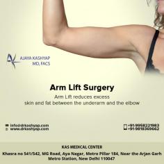 Arm Lift Surgery Delhi is the procedure to reduce extra fat from your body. Some people have the problem of saggy arms and wants to tighten their skin this the only best option to tighten the skin through arm lift surgery treatment.
For more details and see before & after our national & international patients.
WhatsApp: https://api.whatsapp.com/send?phone=919958221983
For more info visit www.drkashyap.com or call now on 9958221983 to book your consultation.
#armlift #armliftinindia #armliftindelhi #cosmeticsurgerydelhi
