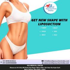 Liposuction surgery is a technique to lose weight but is a useful tool in body sculpting in individuals who have tried to lose the excess fat in certain body areas by means of exercise and dieting

Contact us anytime with any questions you may have, or to schedule your consultation for liposuction surgery clinic in Delhi, India.
Dr. Ajaya Kashyap
Call: +91-9958221983
Email: info@bestliposuctionindia.com
Web: www.bestliposuctionindia.com

#PlasticSurgery #Transformation #Mommy #liposuction #vaserliposuction #bodyjetliposuction #tummytuck

