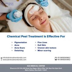 There are many type of chemical peels, such as Glycolic, TCA, Lactic, Salicylic, Kojic, etc. Each type of peel has a specific purpose, or works on a specific type of problem. Peels can also be combined to cover multiple skin issues in one session.

For more information about chemical peel treatment, or to schedule a consultation, please call Dr. Ajaya Kashyap Clinic (KAS Medical Center) today at +91-9818369662, 9958221983 or use our online appointment request form.
For more details visit: www.skintreatmentsindia.com
#chemicalpeel #acnescars #finelines #dullskin #pigmentation #skintreatments
