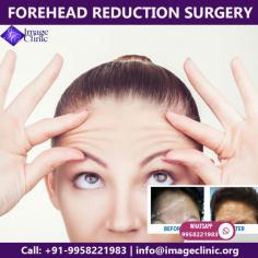 Looking for Best forehead shortening surgery in Delhi, India? We at cosmetic plastic surgery clinic, provide forehead reduction Surgery at affordable cost/ price in Delhi, india by top plastic surgeon doctor - Dr. Ajaya Kashyap at KAS Medical Center. 

Call now on +91-9958221983 to get instant appointments and take the opportunity to avail knowledgeable consultation of Dr. Ajaya Kashyap 

Email: info@imageclinic.org
Web: www.imageclinic.org

#foreheadshortening #foreheadreduction #drkashyap #cosmeticsurgery #plasticsurgeon
