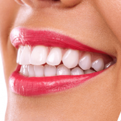Best Orthodontics
If you have issues with your teeth aligning, or a bad bite, you need to see an orthodontist. You can get the best services of an orthodontics from Alexandra Hills Dental. Call us now at  07 3824 4488.