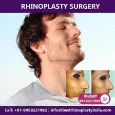 Are you worried about the shape of your nose and if you are thinking about rhinoplasty surgery, then you can consult Dr. Kashyap who is a US board certified surgeon. Dr. Ajaya Kashyap has also performed  Rhinoplasty Surgery on, “NAYA ROOP NAYI ZINDAGI SHOW” (Indian Extreme Makeover Show) telecasted on SONY TV in Year 2008.
 
Contact us anytime with any questions you may have, or to schedule your consultation for nose surgery clinic in Delhi, India.

Dr. Ajaya Kashyap
Call: +91-9958221983
Email: info@bestrhinoplastyindia.com
Web: www.bestrhinoplastyindia.com

#rhinoplasty #nosesurgery #nosejob #nosereshaping #clinic #delhi #india #cosmeticsurgery #plasticsurgeon

