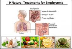 Emphysema usually develops over years and there are Natural Cures for Emphysema that can slow its progress. Some symptoms that you should be on the lookout for include: consistent shortness of breath, headaches, constant coughing, fatigue, wheezing, difficulty concentrating, tightness in the chest, irritability and a distended chest.