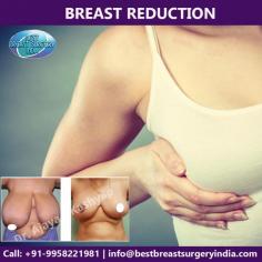 Having large breast is a problem for many women. This can be the cause of chronic back pain and shoulder pain. It also is difficult to find the clothes in the size which look right with the rest of your body. The solution is breast reduction surgery in Delhi, by Dr. Ajaya Kashyap.

If you have been thinking about getting a breast reduction surgery in india, breast reduction procedure cost in Delhi contact us for an appointment where we can discuss your requirements in more details.

Dr. Ajaya Kashyap (MD, FACS)
Web: www.bestbreastsurgeryindia.com
Call: +91-9958221981

#breastreduction #mammoplastyreduction #cosmeticsurgery #plasticsurgeon #Delhi #India #Drkashyap

