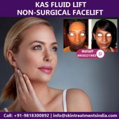 If you have been thinking about face rejuvenation, then KAS Fluid Lift can be a single solution for you. This treatment has been developed by American Board Certified Plastic Surgeon, Dr. Ajaya Kashyap.
This treatment is non-surgical and gives long lasting effects. The technology uses the individual's own fat cells which are then harvested and enriched with platelets, growth factor & stem-cells.

Get the best Cosmetic and Plastic surgery in India at KAS Medical Center. For any kind of enquire about, Non Surgical Face lift procedure please complete our contact form or call +91-9958221983 or +91-9958221982.
YouTube video: https://www.youtube.com/watch?v=g5hqHx7aPuY
Web: www.skintreatmentsindia.com
Book video call consultation please call/WhatsApp: +91-9958221982, 9818300892

#facelift #nonsurgical #kasfluidlift #cosmeticsurgery #cosmeticsurgeon #plasticsurgery #plasticsurgeon #drkashyap #delhi #india
