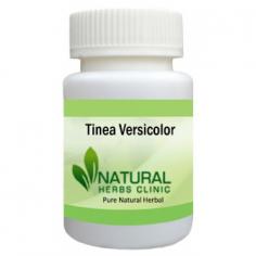 Herbal Treatment for Tinea Versicolor read the Symptoms and Causes. Tinea Versicolor is a fungal infection of the skin. It is a common fungal infection that causes small patches of skin to become scaly and discolored.
https://www.naturalherbsclinic.com/product/tinea-versicolor/

