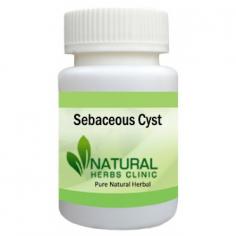 Herbal Treatment for Sebaceous Cyst read the Symptoms and Causes. Sebaceous Cyst is benign, commonly just below the skin of the breast, and may look like a nodule on a mammogram or solid on ultrasound.
https://www.naturalherbsclinic.com/product/sebaceous-cyst/
