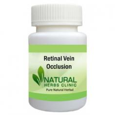 Herbal Treatment for Retinal Vein Occlusion read the Symptoms and Causes. Retinal Vein Occlusion is a blockage of the small veins that carry blood away from the retina. It's a common retina disorder and a major cause of vision loss.
