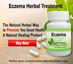 Eczema, also identified as atopic dermatitis, is a skin infection that comes into view as a outcome of stress, dry skin, food allergy, swimming in chlorinated pools. Utilizing of Natural Remedies for Eczema can be providing relief to the skin.
https://www.naturalherbsclinic.com/eczema.php
