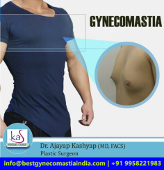 The chest is a prominent part of the body, and for many men, having too much fat or not enough muscle in this area can lower self-confidence. Breast reduction for men is surgery to correct overdeveloped or enlarged breasts (gynecomastia)
Consult your plan for gynecomastia surgery with our US Board Certified Surgeon via appointment.

Schedule a consultation by:
Dr. Ajaya Kashyap
Phone: 9958221981
Email: info@bestgynecomastiaindia.com
Website: www.bestgynecomastiaindia.com
Location: Khasra no 541/542, MG Road, Aya Nagar, Metro Pillar 184, Near the Arjan Garh Metro Station, New Delhi, India

#gynecomastia #malebreastreductionindelhi #gynecomastiaindia #cosmeticsurgery #realself #plasticsurgeon
