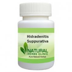 Herbal Treatment for Hidradenitis Suppurativa | Natural Remedies | Natural Herbs Clinic
Herbal Treatment for Hidradenitis Suppurativa read about Symptoms and Causes. Natural Remedies for prevent new boils from forming. Supplement can help manage symptoms.
https://www.naturalherbsclinic.com/product/hidradenitis-suppurativa/