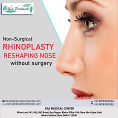 If you are not satisfied with the shape of your nose and wish to alter it, but are worried about surgery, then Non-Surgical Rhinoplasty offers you the best solution. You can now reshape your nose, give it the lift or curve that you’ve always wanted without any surgery.

Take Video Consultation with our doctor from the comfort of your home. To book an appointment for Video Consultation Call or Whatsapp: +91-9818300892

CONTACT US:-
Dr. Ajaya Kashyap (MD, FACS)
Mobile: +91-9818300892
Email: info@skintreatmentsindia.com
Web: www.skintreatmentsindia.com
Location: Aya Nagar, New Delhi, India
