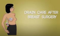 Takes Us Through Drain Care After Breast Surgery in Delhi | Dr. Deepak Jha