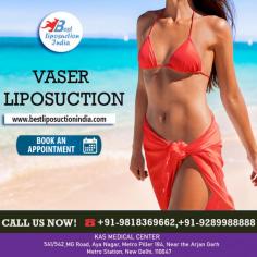VASER Liposuction is an efficient and excellent minimally invasive cosmetic procedure to get rid of stubborn fat deposits. VASER Lipo is successfully used to remove fat deposits from your chest, back, hips, arms, thighs, legs and tummy. You may visit us for a confidential consultation on procedures by our expert plastic cosmetic surgeon Dr. Ajaya Kashyap.

He is a Triple American Board Certified Cosmetic & Plastic Surgeon with over 30 years of experience in which 16 years in the U.S.A. & from the past 14 years he is in Delhi. You can learn more about him and see some of his patient's "before and after" pictures on his website - www.bestliposuctionindia.com


#vaserliposuction #tummyfatremoval #abdominallipodystrophy  #drkashyap #bodyjetliposuction #liposuction #cosmeticsurgery #realself #plasticsurgeon
