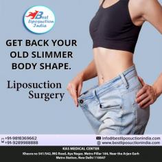 Liposuction is a cosmetic procedure used to remove fat from specific regions of the body, including the arms, neck, hips, thighs, abdomen, and buttocks.

Dr. Ajaya Kashyap Triple American Board certified Plastic Surgeon with over 30 years of experience in which 16 years in the U.S.A. & from the past 14 years he is in Delhi. You can learn more about him and see some of his patient's "before and after" pictures on his website - www.bestliposuctionindia.com

We are offering VIRTUAL CONSULTATIONS so that we can all stay connected during this time! book your consultation by visiting bestliposuctionindia.com and click the link on the websites homepage.

#liposuction #VaserLiposuction #BodyJetLiposuction #WaterJetLiposuction #AffordableLiposuctionCost #cosmeticsurgery #plasticsurgeon #medicalTourism

