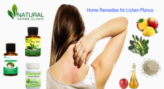 Natural Treatment & Home Remedies for Lichen Planus
There are many Natural Remedies for Lichen Planus which are including oats due to their property of gentle exfoliator and skin soother.
https://naturalherbsclinic.myfreesites.net/natural-treatment/home-remedies-for-lichen-planus

