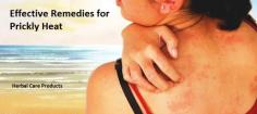 Remedies for Prickly Heat
To learn what to put on prickly heat rash, visit Herbal Care Products You'll find dozens of articles about skin problems and skin care by clicking on common skin problems. If you are trouble by prickly heat and want to buy Herbal Supplements for Prickly Heat to soothe the skin and prevent more eruptions.