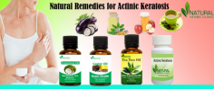Tested Natural Remedies for Actinic Keratosis Treatment
Castor oil can be used as one of the potential Natural Remedies for Actinic Keratosis treatment naturally. Not everybody has experienced success with it but it has no adverse side effects and is worth trying.
https://www.naturalherbsclinic.com/blog/tested-natural-remedies-for-actinic-keratosis-treatment/
