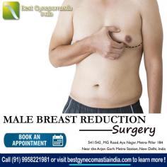 If you are interested in learning more about a Male Breast Reduction, and would like to see if you are a good candidate, contact us to schedule a consultation at our office located in Aya Nagar, New Delhi, India.

Dr. Ajaya Kashyap Triple American Board certified Plastic Surgeon with over 30 years of experience in which 16 years in the U.S.A. & from the past 14 years he is in Delhi. You can learn more about on his website - www.bestgynecomastiaindia.com

We are offering VIRTUAL CONSULTATIONS so that we can all stay connected during this time!

