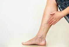 Generally for diagnosing the varicose veins or spider veins, vein doctors in New Jersey at vein clinics for the vein treatment Woodland Park have a tendency to take a look immediately upon your legs at the period of time you are standing or sitting down.
