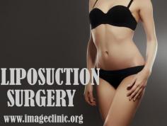 Liposuction is a cosmetic surgical procedure that slims and reshapes specific areas of the body by removing excess fat deposits and improving body contours.

The best way to decide if a liposuction surgery is right for you is to consult with a board certified surgeon. Dr. Ajaya Kashyap Triple American Board certified Plastic Surgeon with over 30 years of experience in which 16 years in the U.S.A. & from the past 14 years he is in Delhi. You can learn more about on his website - www.imageclinic.org

We are offering VIRTUAL CONSULTATIONS so that we can all stay connected during this time! 


Schedule a consultation by:
Dr. Ajaya Kashyap
WhatsApp: https://api.whatsapp.com/send?phone=919958221981
Location: Aya Nagar, New Delhi, India

#liposuction #VaserLiposuction #BodyJetLiposuction #WaterJetLiposuction #AffordableLiposuctionCost #cosmeticsurgery #plasticsurgeon #medicalTourism

