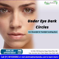 We have had excellent results treating dark circles under the eyes with a combination of topical ointments, peels and carboxytherapy. There is often a slight hollowness called the “tear trough” associated with these circles and this can be improved with fillers.

In our clinic, you are always welcome to inquire about the cost of Under Eye Dark Circle Treatment in Aya Nagar, New Delhi, feel free to write to us regarding your desired result and any questions you may have about the surgery.

Schedule a consultation by:
Dr. Ajaya Kashyap
Web: www.skintreatmentsindia.com
Location: Aya Nagar, New Delhi, India

#darkcircleundereye #fillertreatment #Kasmedicalcenter #drajayakashyap #bestcost #skintreatment #darkcircle #undereyedarkcircle #nonsurgical
