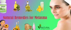 Lemon juice is the best Natural Remedies for Melasma cure. Its acidic nature and vitamin C component improve the discolorations and peel off the outer layer of the skin.
