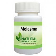 Herbal Treatment for Melasma read the Symptoms and Causes. Natural Remedies for Melasma effective for curing skin problem. Supplement help lighten the dark patches.
