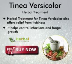 Herbal Treatment for Tinea Versicolor reduces skin issue that causes patches on the neck and back. Herbal Remedies for Tinea Versicolor treats the infection without any pills.
https://www.herbal-care-products.com/product/tinea-versicolor/