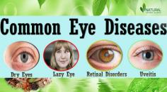 Most people have eye diseases all at once or another. A couple is slight and will disappear on them self, or are easy to treat at home.
