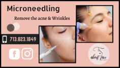 Invasive Procedure to Clear Small Wounds

Microneedling treatment recreates an important role to remove acne, face lines, and wrinkles with help of sterilized needles involving a superficial controlled professional dermatologist at About Face Skin Therapy. 