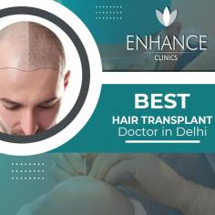 Dr Manoj Khanna is the Best Hair Transplant Doctor in Delhi