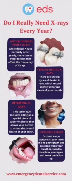 Do I Really Need X-rays Every Year? | Emergency Dental Service

Dental X-Rays have become a common adjunct to a routine dental exam and are a standard of care practice, helping detect early signs of tooth decay, monitor jaw and tooth formation for adolescents and observe overall oral health not visible to the naked eye. Dental X-rays can also assist in helping your dentist plan, Our Team Provides the best 24 Hour Dentist in Morganville, NJ-07751, at an affordable price. For more information visit our website https://www.emergencydentalservice.com
