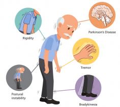 Parkinsons disease is a progressive nervous system disorder that affects movement. Symptoms start gradually, Parkinsons disease treatment can not be cured, but medications can help control your symptoms, often dramatically. in some more advanced cases, surgery may be advised.