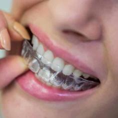 If you have issues with your teeth aligning, or a bad bite, you need to see an orthodontist. You can get the best services of orthodontics from Alexandra Hills Dental. Call us now at 07 3824 4488.