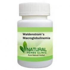 Herbal Treatment for Waldenstrom's Macroglobulinemia read the Symptoms and Causes. Waldenstrom's Macroglobulinemia and Supplement reduce the quantity of abnormal blood.