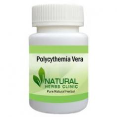 Herbal Treatment for Polycythemia Vera read the Symptoms and Causes. Natural Remedies for Polycythemia Vera prevent complications. Supplement treats underlying causes.