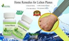 If you are one of the many people who have adverse effects after stereoscopic medication, there are a number of Home Remedies for Lichen Planus that may help. These therapies have the advantage of being safe and unlikely to have any negative side effects.
https://www.naturalherbsclinic.com/blog/how-to-utilize-lichen-planus-home-remedies-to-treat-it/