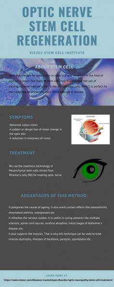 Looking for stem cell therapy for optic nerve atrophy in Delhi, India of optic nerve damage or hypoplasia? Viezec helps to get optic nerve stem cell treatment in Delhi. 