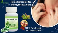 Uses of Home Remedies for Polycythemia Vera can be very useful option to reduce the symptoms and causes. These remedies are made with pure herbal ingredients that have no side effects to utilizing.
https://www.naturalherbsclinic.com/blog/how-to-utilize-polycythemia-vera-home-remedies/