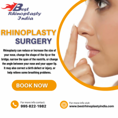 Rhinoplasty to reshape the nose has become popular all over the world to redefine, refine and sometimes even to restore the appearance of the nose. The nose defines the central part of the face and a well shaped nose brings balance to the face. The aim during the procedure is to bring the nose in harmony with the rest of the face. You can learn more about on his website - https://bit.ly/1SS7H8a