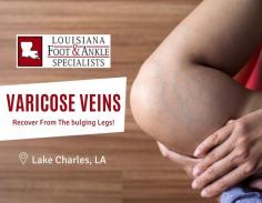 Healing The Wounded Bloated Condition 

Our special doctors will diagnose the vein and vascular conditions of the patient who is suffering from this problem. The Louisiana Foot and Ankle Specialists LLC treat your varicose veins to remedy their impression. To know more dial at (337) 474-2233.