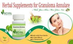 Home Remedies and Herbal Supplements for Granuloma Annulare are very famous techniques to keep skin safe from skin illness germs.
