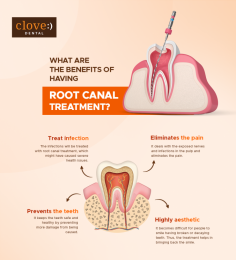 There are too many benefits of having root canal treatment. Root Canal Treatment helps in teeth pain, infection, prevents the teeth and many more.
