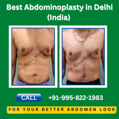 Also known as Abdominoplasty, a Tummy Tuck removes excess fat and skin, and restores weakened or separated muscles creating an abdominal profile that is smoother and firmer. 
✅ 35+ years experience
✅ Triple American Board Certified Plastic Surgeon
Call +91-9958221983 or share your contact details, our medical counselor will help you to plan the treatment.