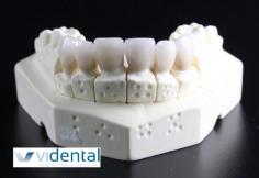 Virgin Island Dental Center | Denture Care | St. Thomas Dentist, St. Croix Dentist

Advice and tips on caring for your dentures. Only your dental professional is qualified to diagnose your oral health and adjust your denture or partial. 