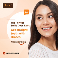 
Everyone loves a straight delightful smile. Did you know, that braces not just fix Crooked Teeth, they can also improve bite issues, and elevate the overall appearance of the smile? Our orthodontists are here to guide you through the procedure, make an appointment here: 
