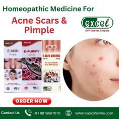 Are you worried about Acne, Pimples & Acne Scars? Don't Worry! Homeopathy has a solution. Excel Pharma is among the largest providers of effective Homeopathic medicines, including Homeopathic medicine for acne, pimples, and acne scars, at reasonable prices. Homeopathic Medicines for Pimples, acne & acne scars are very effective for all skin types without causing any side effects. You can order your medicine online and also get an online/offline consultation with our expert doctor by calling on +91 9815567678. For additional details, visit our website.
