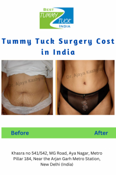 Know cost for Tummy tuck/Abdominoplasty Surgery with 
✅Triple American board certified surgeon
✅ 35+ years experience
Delhi (India)
schedule a consultation  
Call at: +91-995-822-1983 
website : www.besttummytuckindia.com