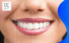 Best Dental clinics in Al Batin
